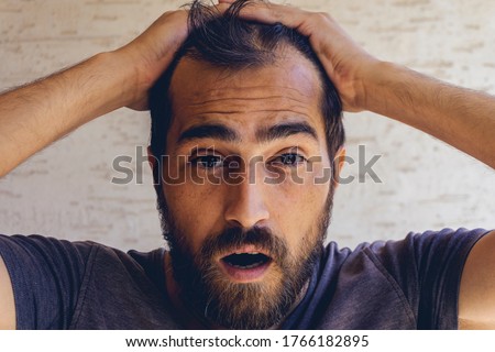 Man using his hand slicking his hair back after facing hair loss problem by taking medicine like zinc and biotin to make his hair grow faster and thicker. Men health and medical concept. Royalty-Free Stock Photo #1766182895
