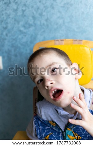 Boy with cerebral palsy in the conditions of his apartment. He reacts vividly to everything that happens around him and shows it with his personality. High quality photo