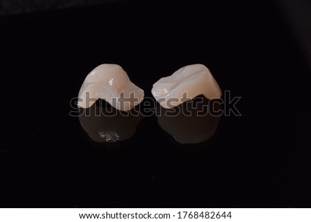 indirect partial zirconia oxide restorations Royalty-Free Stock Photo #1768482644