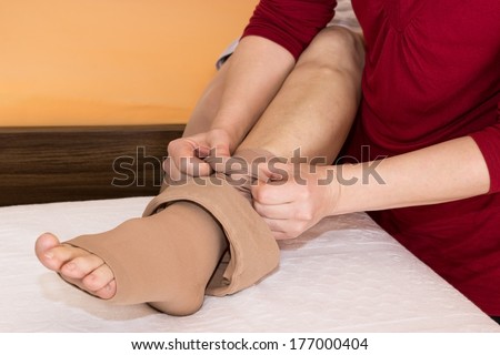 Nurse helping someone putting on thrombosis stockings