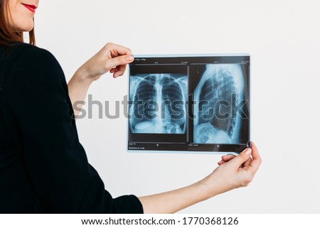 Girl holding a picture of lungs, x-ray Rays, doctor, diseases and health, proper nutrition, body