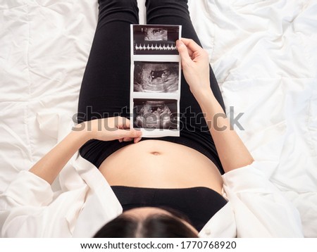 3 months pregnant Asian woman in white bed room, showing her ultrasound film. Woman touching her abdomen belly and looking at x-ray film.