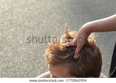 Relaxing head massage outdoors in the city. Closeup photo of a hand and a head.