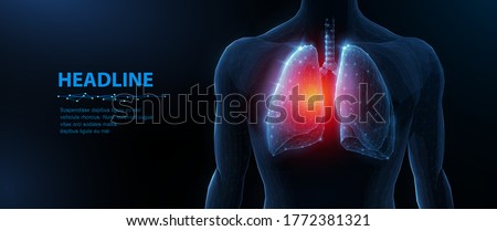 Lung disease in human body. Abstract vector 3d lungs and red spot. Human health, respiratory system, pneumonia illness, biology science, smoker asthma, healthcare concept. Organ anatomy illustration Royalty-Free Stock Photo #1772381321
