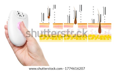 Epilation procedure. Woman holding modern appliance near illustrations of hair follicle removing on white background, closeup