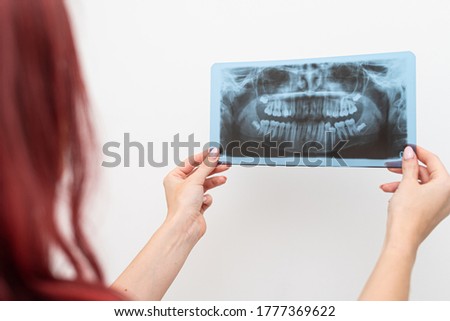 Doctor orthodontist analyzes the orthopantomogram of the patient's jaws to diagnose