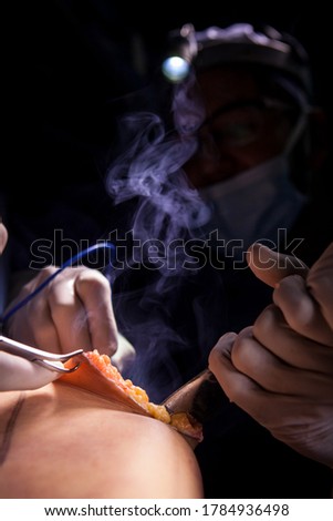 Plastic Surgeon in 
operating room