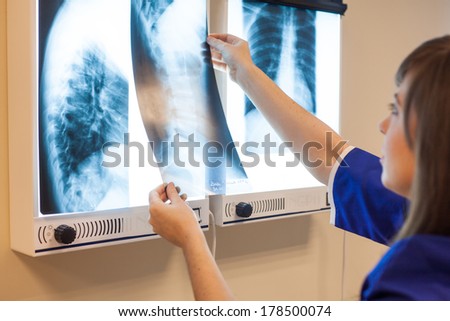 Female doctor examining x-ray images in hospital. She is wearing blue overall