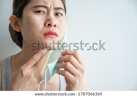 Asian woman worry about acne occur on her face after wearing mask for long time during covid-19 pandemic. Wearing mask for prolonged periods can damage the skin. Royalty-Free Stock Photo #1787066369