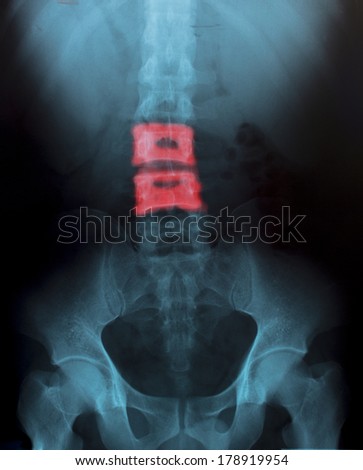 X-Ray Image Of Human  for a medical diagnosis