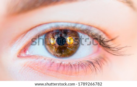 Yellow cat eyes reflection in a girl's eye