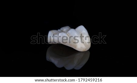 dental inlay made of ceramic with morphology on the chewing tooth, filmed on black glass with reflection Royalty-Free Stock Photo #1792459216