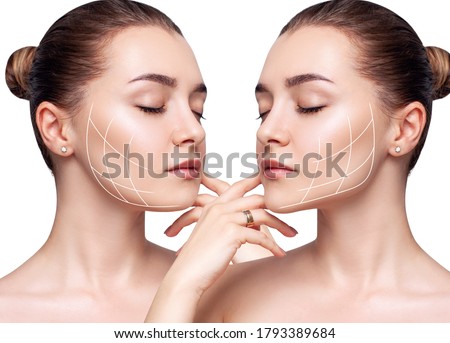 Young beautiful woman with lifting lines before and after chin correction. Over white background. Royalty-Free Stock Photo #1793389684