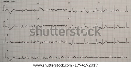 RBBB-PATTERN Stock Photos and Images - Avopix.com