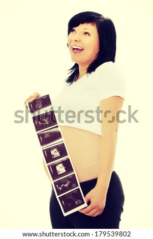 A pregnant woman is holding her stomach and a photo of her Ultrasound.
