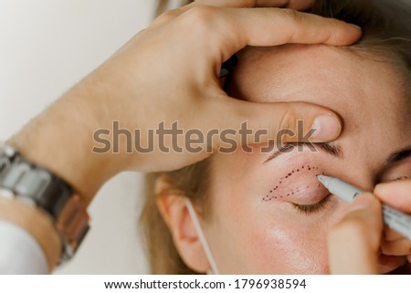 Blepharoplasty markup close-up on the face before the plastic surgery operation for modifying the eye region of the face in medical clinic. 2 doctors do plastic cosmetic operation Royalty-Free Stock Photo #1796938594