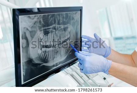 Hands doctor dentist in gloves show the teeth on x-ray on digital screen in dental clinic on light background with medical equipment. Smile healthy teeth concept, close up Royalty-Free Stock Photo #1798261573