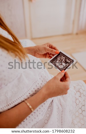 Pregnant woman looking at her baby twins sonography. Happy expectant mother enjoying first photo of her kids, face is unrecognizable