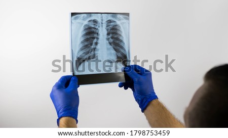 X-ray of the lungs in the hands of a doctor,a medical worker looks at an X-ray,pneumonia of the lungs,makes a diagnosis in the hospital from a picture of the lungs,close-up