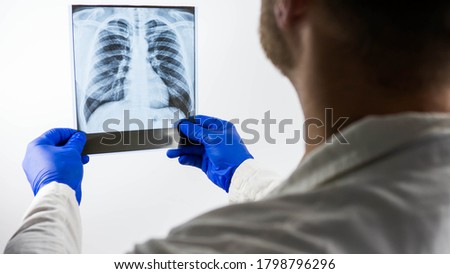 A doctor looks at an x-ray of a person's lungs on a white background.A medical worker in a white coat with an X-ray picture in his hands makes a diagnosis,conclusion,pneumonia of the lungs,edema