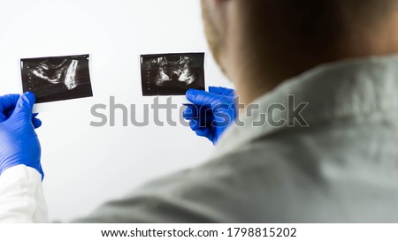 Ultrasound of the prostate gland in the hands of a doctor,to make a diagnosis, close-up.Demonstration of the disease on the ultrasound images of the prostate,on a white background. Royalty-Free Stock Photo #1798815202