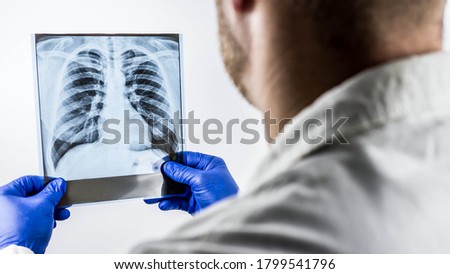X-ray of the lungs of a healthy person on a white background in the hands of a doctor,a picture of the lungs for studying the disease,making a diagnosis,a medical worker in the office examines lungs