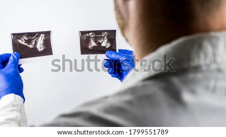 The doctor examines the ultrasound images of the prostate gland,prostate pictures in the hands of a medical worker,on a white background Royalty-Free Stock Photo #1799551789
