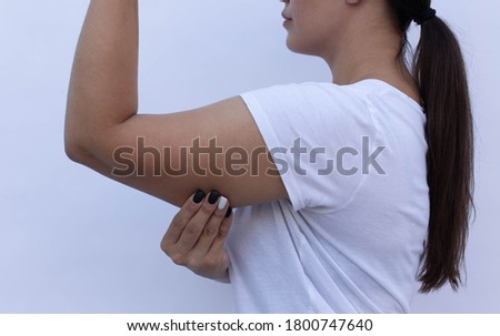 Bingo wings, female arm with loose skin. Royalty-Free Stock Photo #1800747640