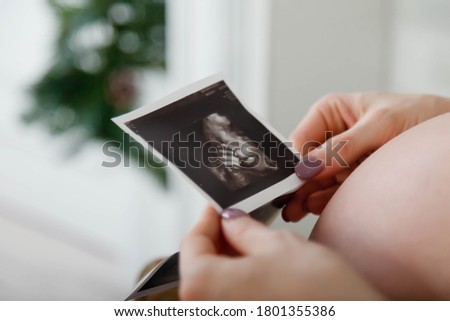 Woman pregnant with twins in hand an ultrasound scan of her babies. Close-up of female hands on light background. Happy family pregnancy, waiting. Black and white photo scanning