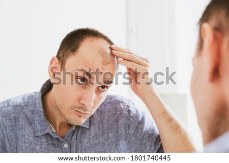 Male pattern hair loss problem concept. Young caucasian man looking at mirror worried about balding. Baldness, alopecia in males. Royalty-Free Stock Photo #1801740445