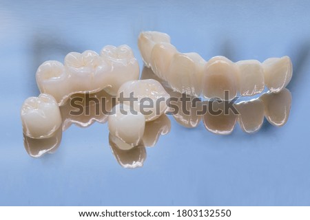 Metal Free Ceramic Dental Crowns. Ceramic zirconium in final version. Staining and glazing. Precision design and high quality materials. Royalty-Free Stock Photo #1803132550