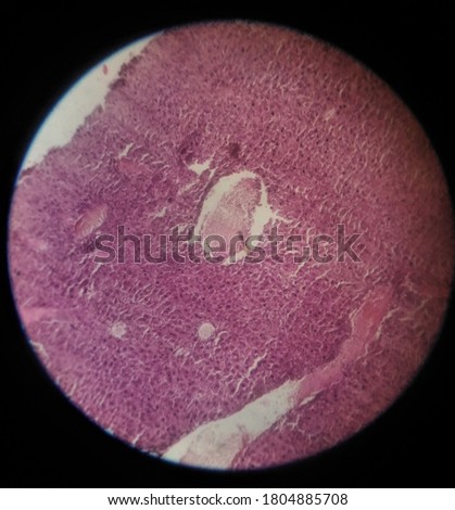 MAMMALIAN-KIDNEY Stock Photos and Images - Avopix.com