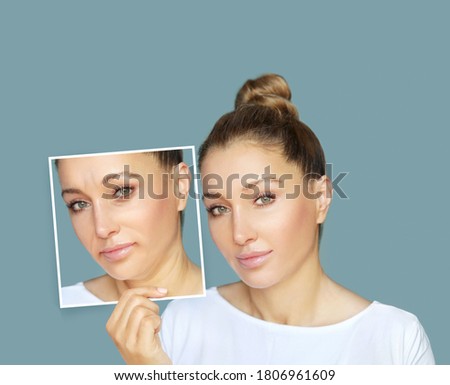 Effects of ageing,Frown/scowl lines ,Nasolabial folds,Neck ,Under eye circles,neck lines. Plastic Surgery Results Royalty-Free Stock Photo #1806961609