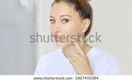 thread lift procedure ,non-surgical facelift,markup Royalty-Free Stock Photo #1807450384