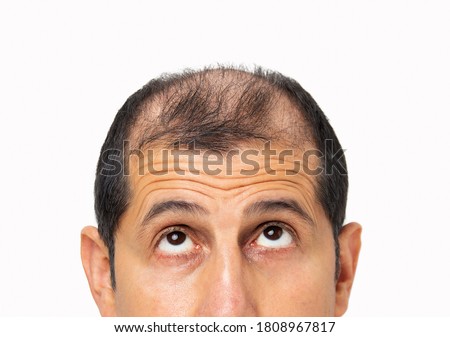 Young bald man  over white isolated background looking up sad, upset, unhappy and depressed. Royalty-Free Stock Photo #1808967817