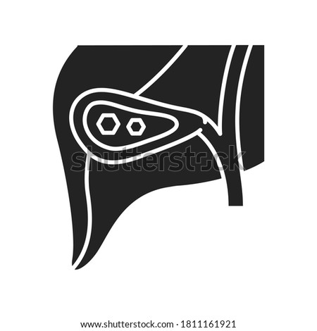 Pancreatic stones black glyph icon. Acute pancreatitis. Human organ concept. Sign for web page, mobile app, button, logo. Vector isolated element.