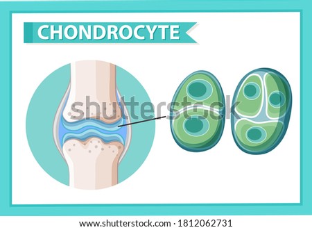 Informative poster of chondrocyte illustration