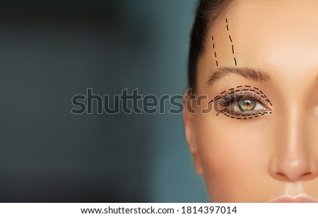 Lower and upper Blepharoplasty.Marking the face.Perforation lines on females face, plastic surgery concept. Royalty-Free Stock Photo #1814397014
