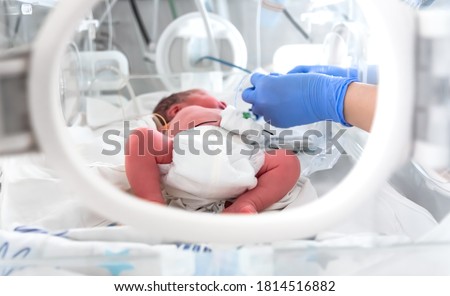 Photo of a premature baby in incubator. Focus is on his feet. Nurse in blue gloves is using the feeding tube for feeding premature baby. Neonatal intensive care unit Royalty-Free Stock Photo #1814516882
