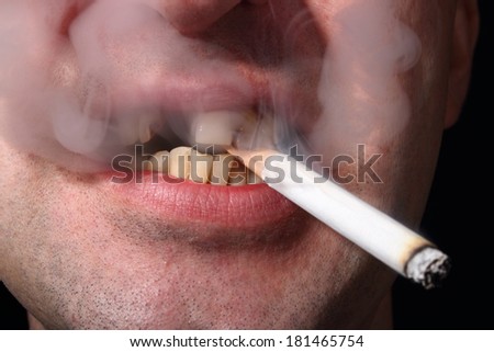 Bad teeth smoker