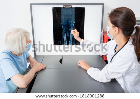 Rheumatologist consulting an elderly patient by pointing to X-ray of knee joint. Arthritis and disease of the joints of the legs Royalty-Free Stock Photo #1816001288