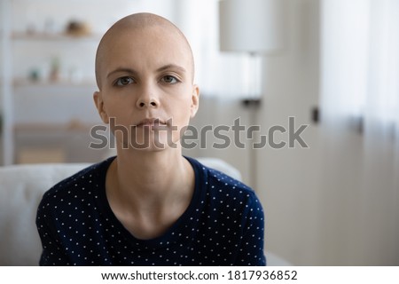 Profile picture of tired unhappy sick young hairless woman struggling with oncology lack energy. Headshot portrait of sad distressed ill bald female patient suffer from cancer. Healthcare concept.