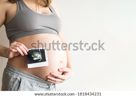 Pregnant woman with ultrasound scan of her baby. Pregnant woman is holding her stomach and a photo of her Ultrasound. Copy space. Royalty-Free Stock Photo #1818434231