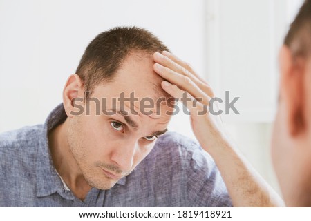 Male pattern hair loss problem concept. Young caucasian man looking at mirror worried about balding. Baldness, alopecia in males. Royalty-Free Stock Photo #1819418921