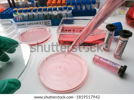 Scientist working on sars-cov-2 coronavirus covid-19 on a petri dish in the laboratory, conceptual image Royalty-Free Stock Photo #1819517942