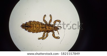 Chicken lice under the microscope.