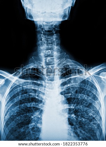 Film x-ray skull and spine of patient