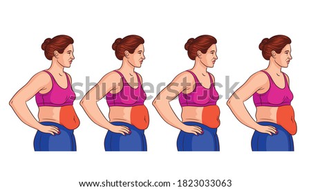Color vector illustration isolated on white background. Four types of belly in women. Overweight woman side view. Problem areas in women on the stomach Royalty-Free Stock Photo #1823033063