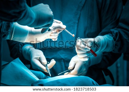 concentrated professional surgical doctor team operating surgery a patient in the operating room at hospital. tumor cancer. surgical biopsy specimens. healthcare and medical concept.
 Royalty-Free Stock Photo #1823718503