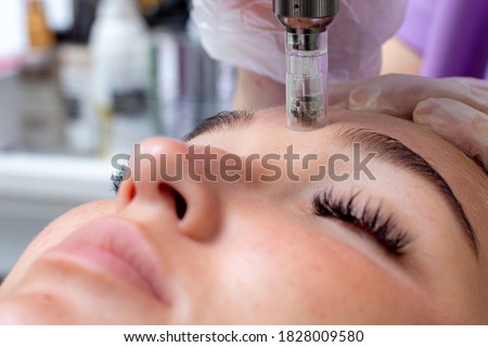 Fractional microneedle facial therapy close up Royalty-Free Stock Photo #1828009580
